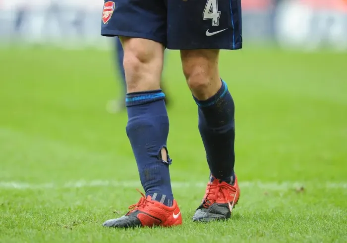 Framed Print : Arsenal captain Cesc Fabregas socks after a challenge from a Stoke player